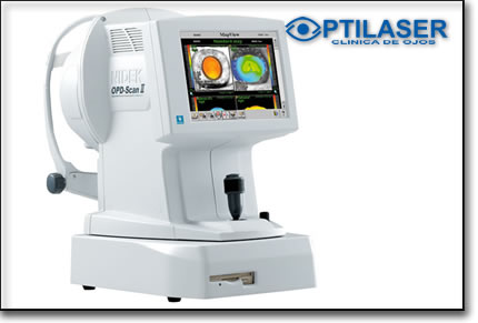 Clinica de ojos Optilaser - Topografia corneal